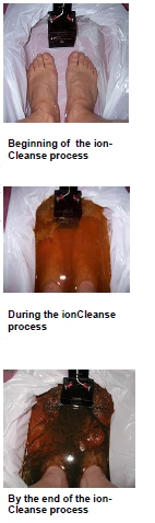 IonCleanse